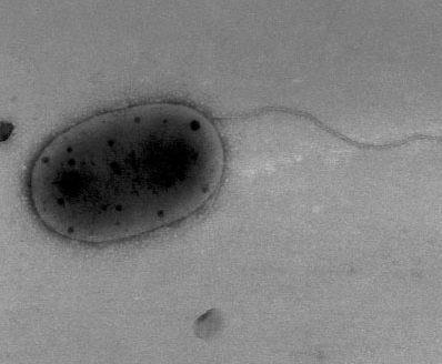 کشف میکروب های ناشناخته در ایستگاه فضایی بین المللی - Methylobacterium jeotgali