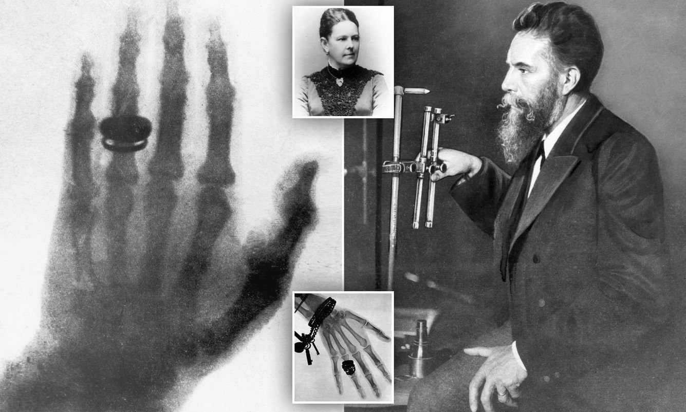 first X-Ray imaging