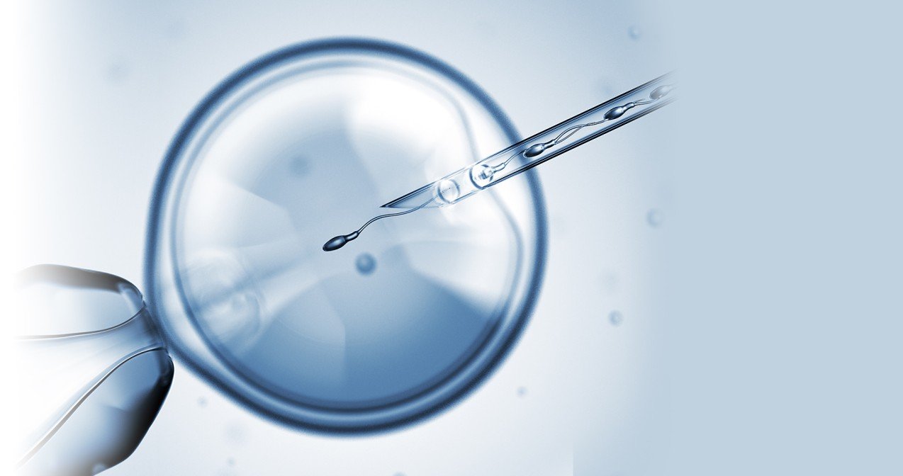 vitro fertilization