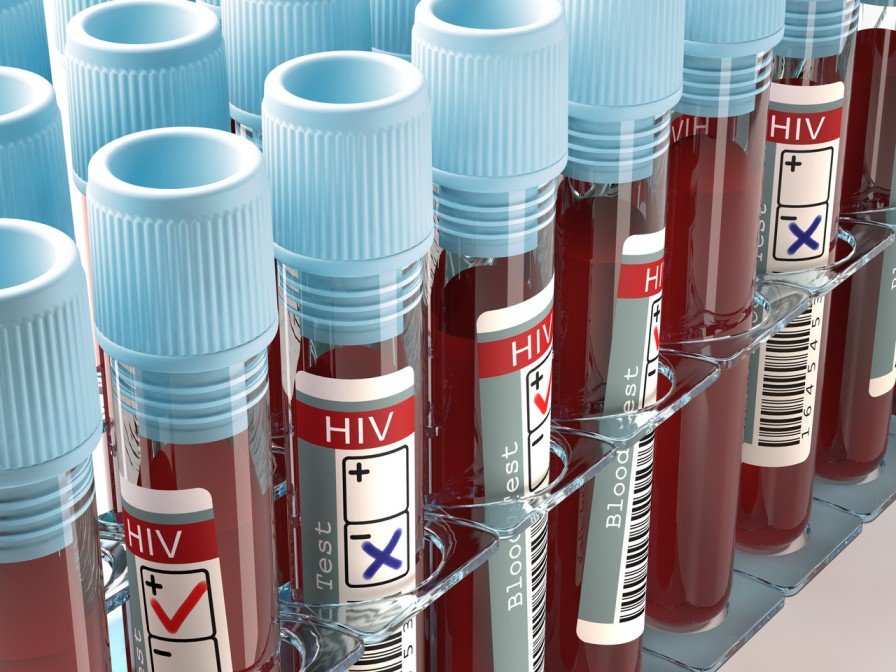 woman was naturally cured of the hiv virus